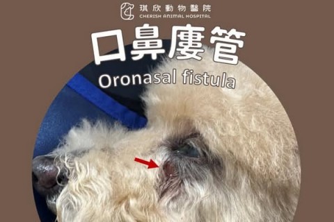 口鼻瘻管