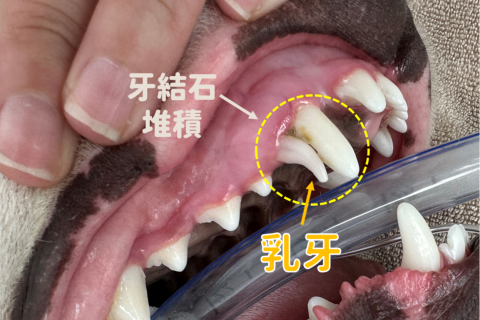 【牙科】永存性乳牙（Persistent deciduous teeth）